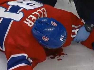 brutal-and-illegal-hit-left-a-hockey-player-in-a-pool-of-blood.jpg