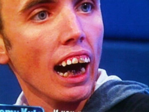 ... having bad teeth only really applies to our trailer trash - the chav