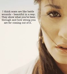 Physical AND emotional scars. 