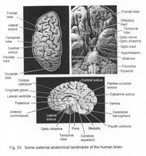 download this Label Diagram The Brain Medulla Oblongata Cerebellum ...