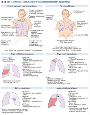 Key Features On Examination Of Common Respiratory Disease