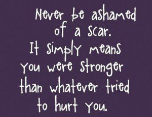 Never be ashamed of a scar