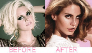 Lana Del Rey Surgery