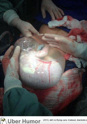 section newborn with amniotic sac intact. The baby still breaths ...