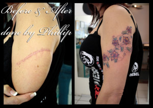 Scar Cover Up Tattoos