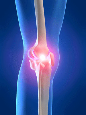 Viscosupplementation- Osteoarthritis Knee Pain Treatment