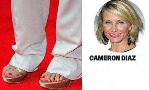 Celebrities with Ugly Feet