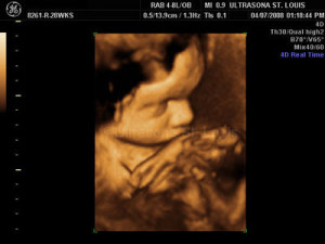 4D ULTRASOUND PICTURES 28 WEEKSimage gallery