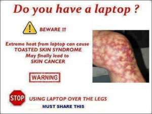 ... from laptop can cause toasted skin syndrome may finally lead to skin