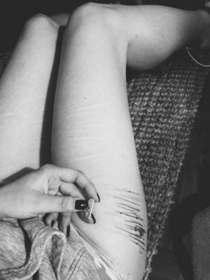 cutting on the side of her thigh