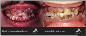 DIET-SODA-TEETH-facebook.jpg