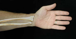 The larger bone shown above is called the radius. It is on the thumb ...