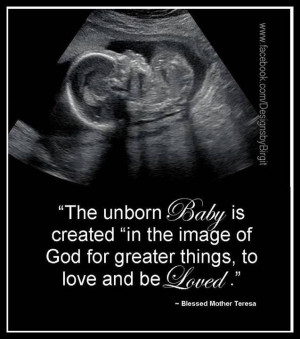 the unborn baby