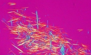 Uric Acid Crystals in Polarized Light