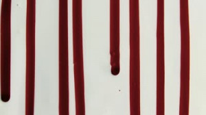 ... lines of blood running down a white fluid surface. - HD stock video