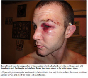 Three Men Charged with Hate Crimes in Vicious Texas Gay Bashing