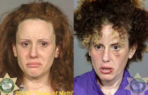 meth_addicts_before_and_after_640_12