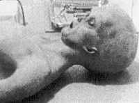 Alien Autopsy Roswell