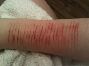 scratch or a cut. A gun or a noose. Whatever it is, its all self ...