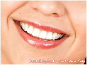 If you’re thinking about Smile Veneers vs. Lumineers in Costa Rica ...