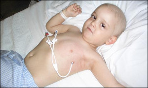 Fewer kids dying from leukemia: study