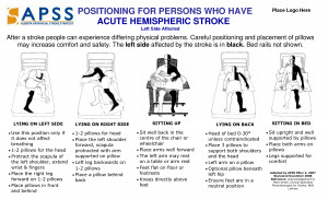 Bed Positioning for Stroke Patients