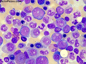 bone marrow histology
