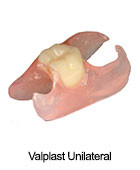 Unilateral Valplast Partial Dentures