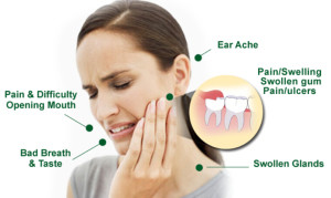 ... Teeth Pain Symptoms-How to tell if the wisdom tooth is impacted