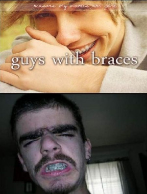 guys with braces at pmslweb guys with brace