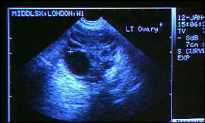 Ultrasound Technicians Help