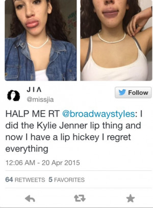 Kylie Jenner Challenge is Taking Over the Net & It’s GROSS! (VIDEO)