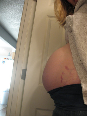 Belly Button in or out? Still in, but barely.