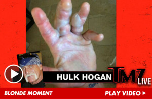 Hulk Hogan I Won’t Miss TNA Event Because of Burned Hand