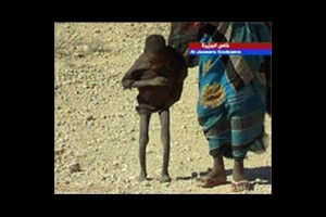 Malnutrition Picture Slideshow