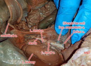 Fetal Pig Common Iliac Artery