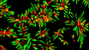 ... Oliver Bruestle, iPSC-derived neural stem cells (Nestin, green; Dach1