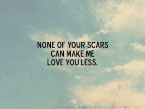... Quotes » Love » None of you’re scars can make me love you less