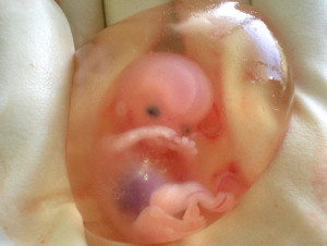 Baby inside the amniotic fluid