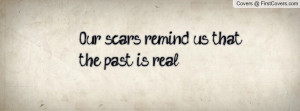 our_scars_remind_us-59445.jpg?i
