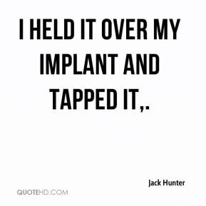 Jack Hunter - I held it over my implant and tapped it,.