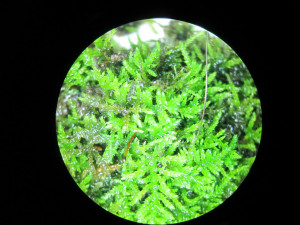 Moss Sporophyte Under Microscope