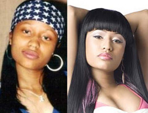 ... before and after surgery (image credit:www.nicki-minaj-quotes.com