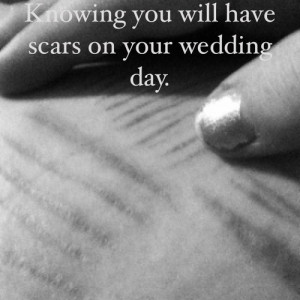 self harm #scars #self harm scars #wedding #wedding day