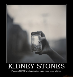 Thread: Kidney stones