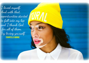 We caught up with Vitiligo Spokemodel Chantelle Winnie to share her ...