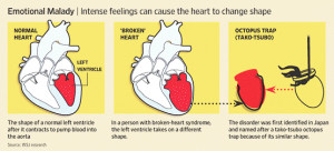 Tako-Tsubo Syndrome: The Broken Heart Disease