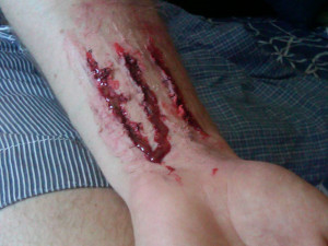 Slit Wrist Photo Slitwrist