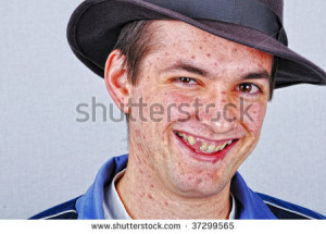 Young funny man with many acne on face smiling