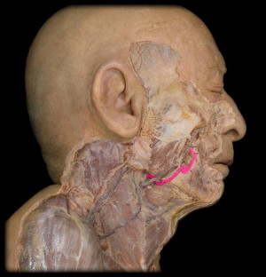 Cutting Carotid Artery